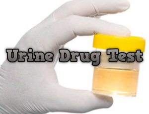 Learn How To Pass A Urine Drug Test.