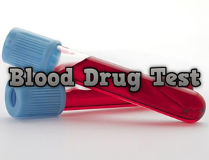 How To Pass A Blood Drug Test.